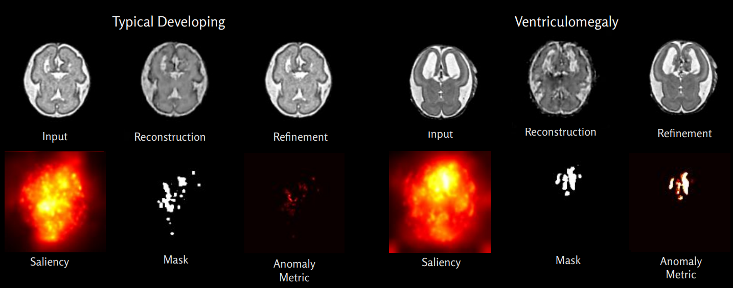 Anomaly detection results